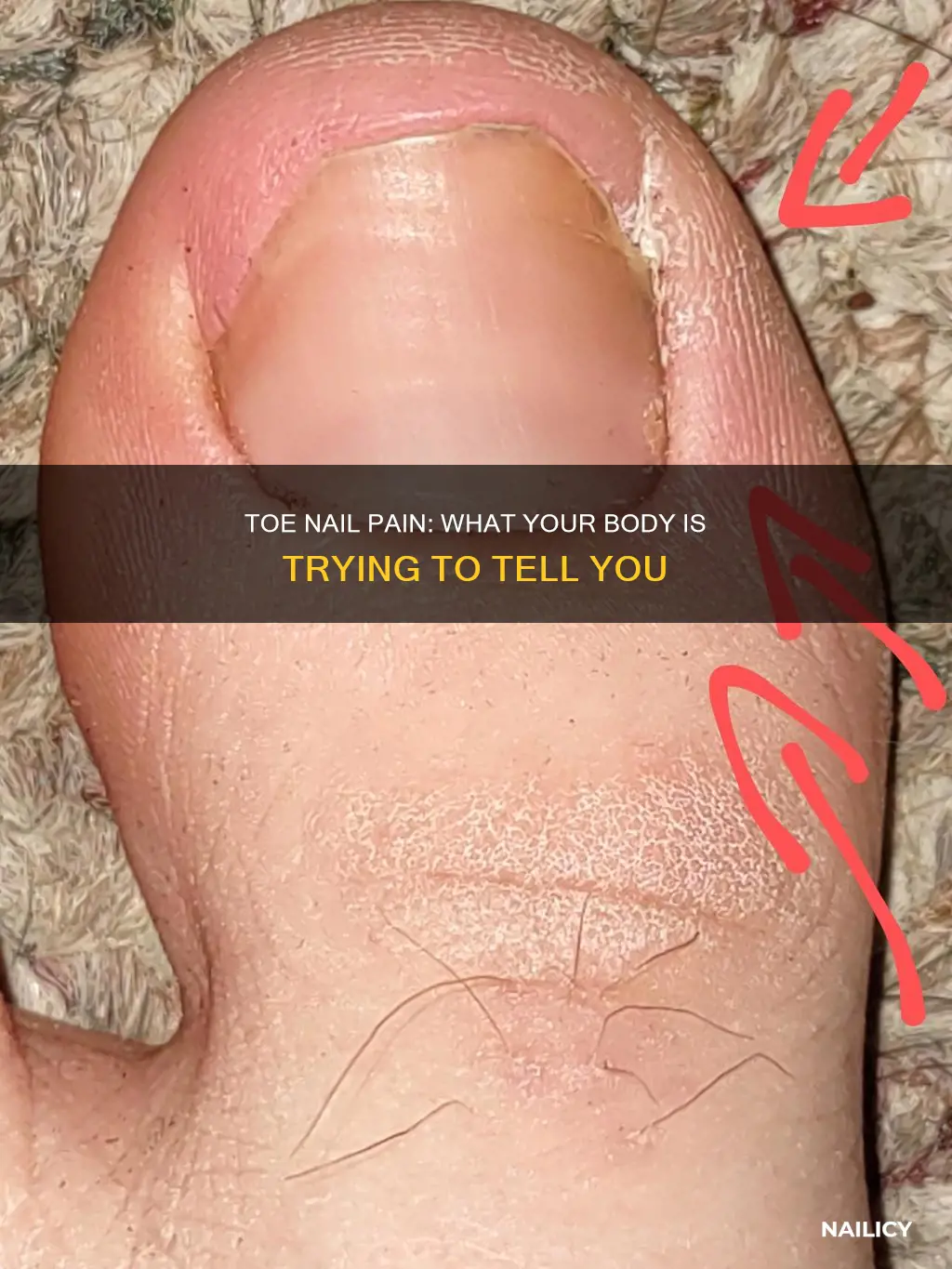 what does it mean when your toe nail hurts