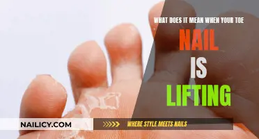 Toe Nail Lifting: What Does It Mean?
