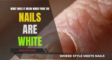 Understanding the Mystery: Why Your Toe Nails Turn White