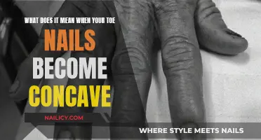 Toe Concerns: Concave Nails and What They Mean