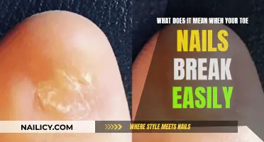 Toe Nail Breakage: What Your Body Is Telling You?