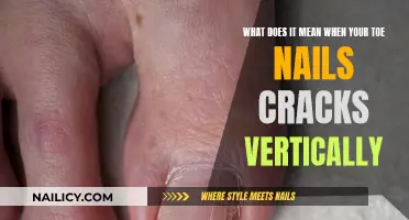 Understanding the Causes of Vertical Toe Nail Cracks