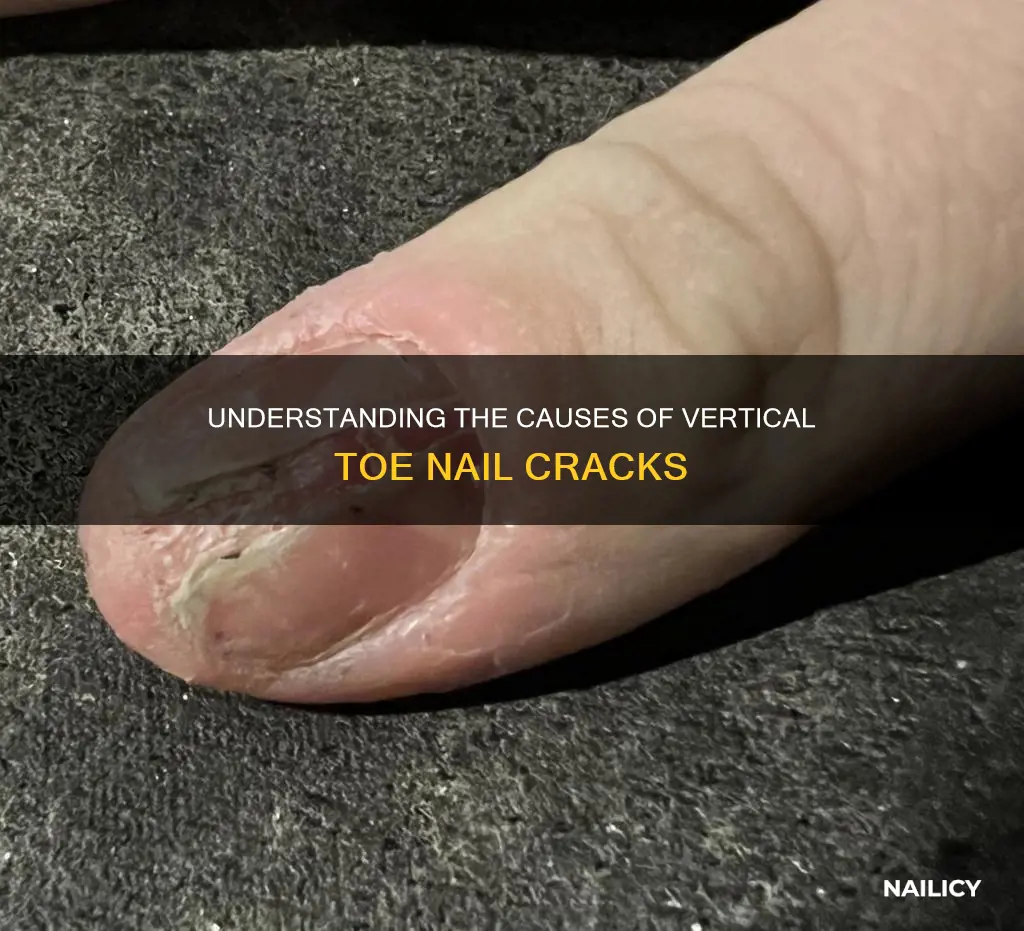 what does it mean when your toe nails cracks vertically