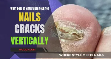 Toe Nail Vertical Cracks: What Your Body is Telling You