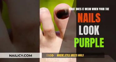 Purple Toe Nails: Understanding the Color Change and Its Causes