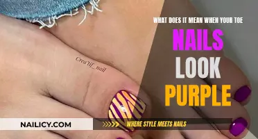 Toe Nails Turning Purple: What Does It Mean?