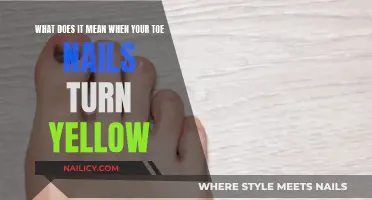 Yellow Toenails: What Does It Mean?