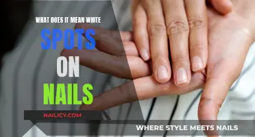 White Spots on Nails: What Your Body Is Telling You