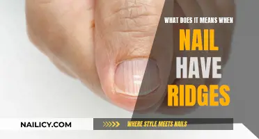 Nail Ridge Signs: Understanding the Causes and Solutions