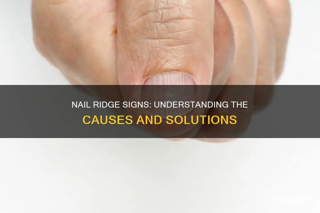 what does it means when nail have ridges