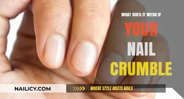 Why Do My Nails Crumble? Causes and Solutions Explained