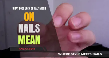 Mystery of the Missing Half-Moon: What Your Nails Say
