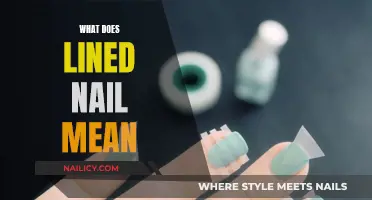 The Meaning of Lined Nails and What to Do About Them