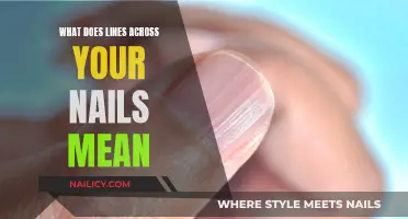 Unraveling the Mystery: Lines on Your Nails and What They Mean