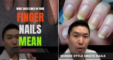 The Mystery of Lines on Fingernails: What Do They Mean?