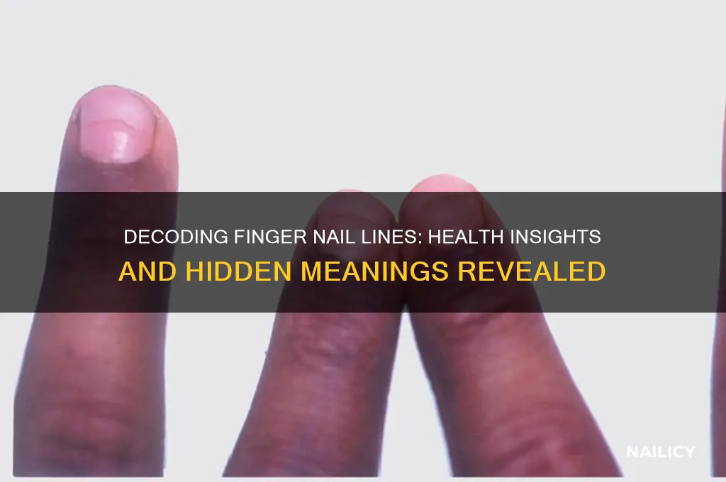 what does lines on figner nails indicate