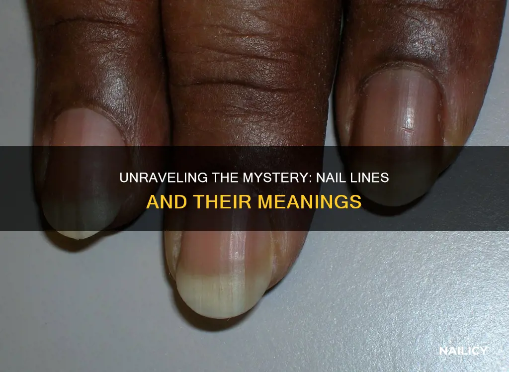 what does lines on the nails mean