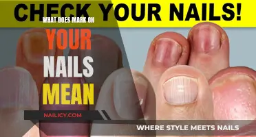 Unraveling the Mystery: Markings on Your Nails