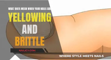 Yellowing, Brittle Nails: What Your Body Is Telling You