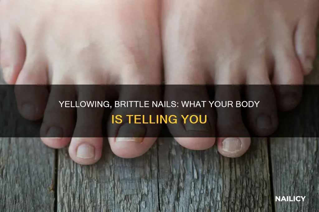 what does mean when your nails are yellowing and brittle