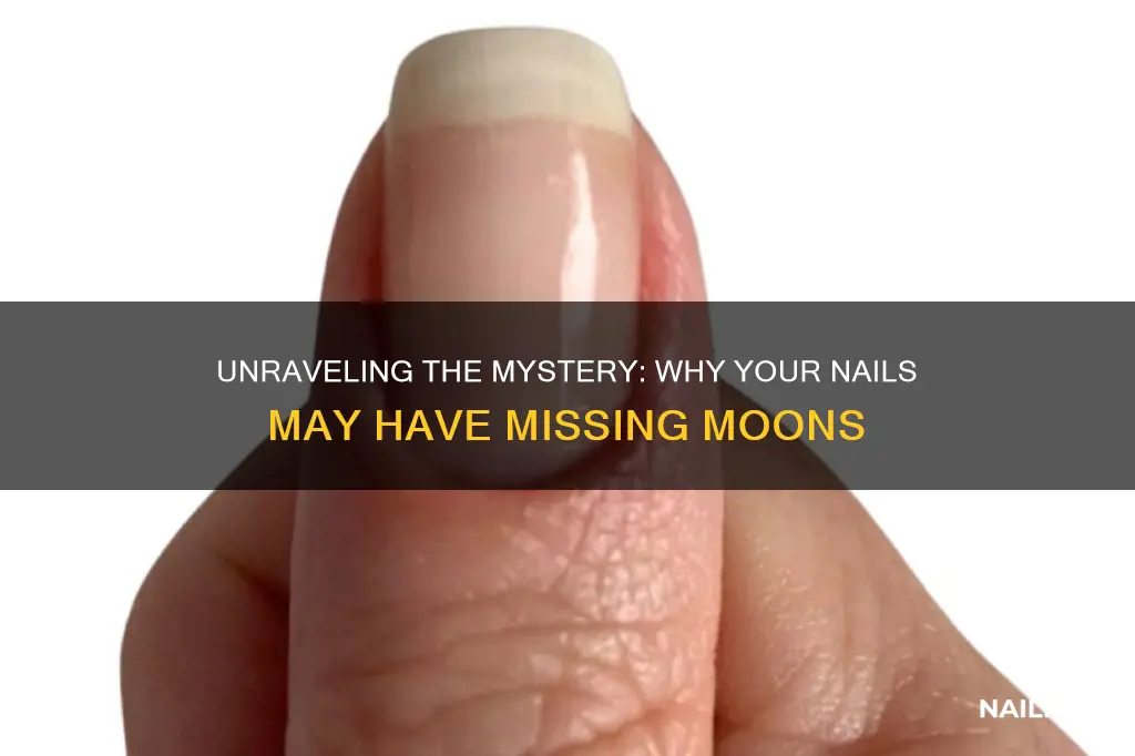 what does missing moons of nail mean