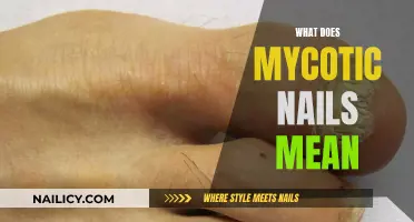 Understanding the Mystery: What Are Mycotic Nails?