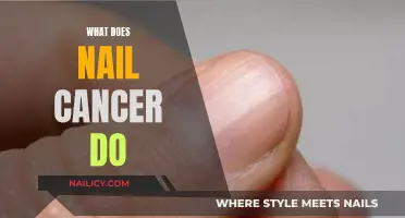 Understanding Nail Cancer: Symptoms, Diagnosis, and Treatment Options
