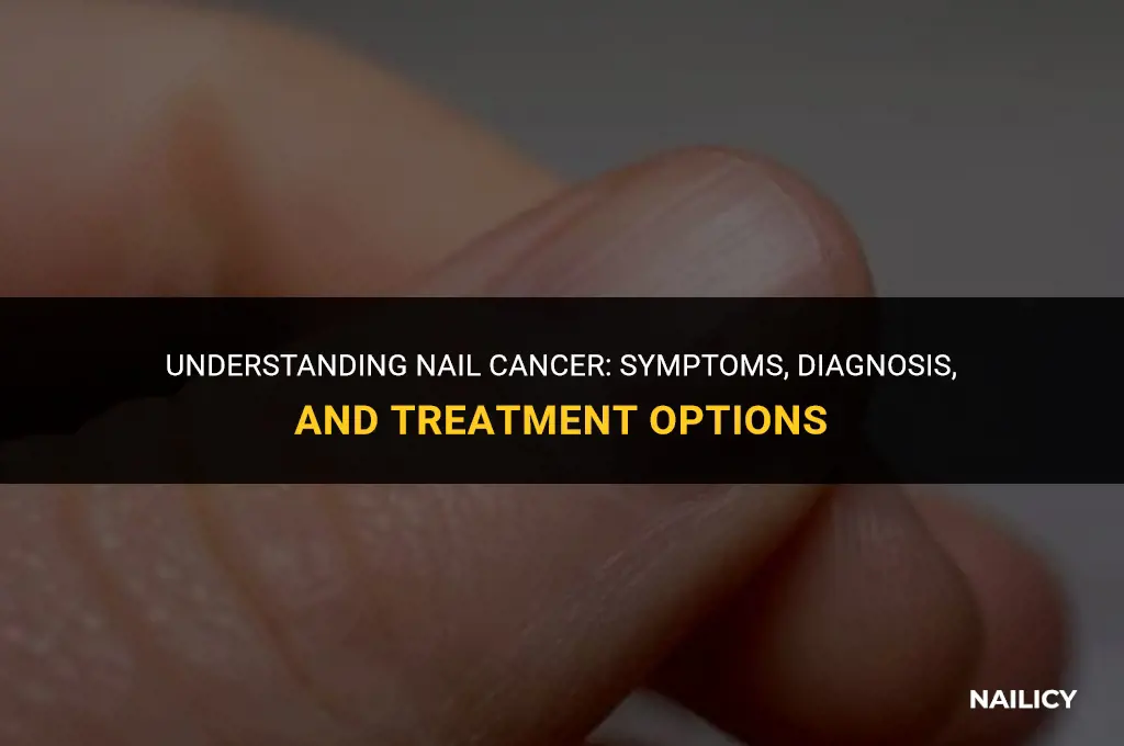 what does nail cancer do