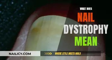 Understanding Nail Dystrophy: What Does It Mean?