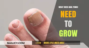 Nail Fungi: Perfect Conditions for Growth