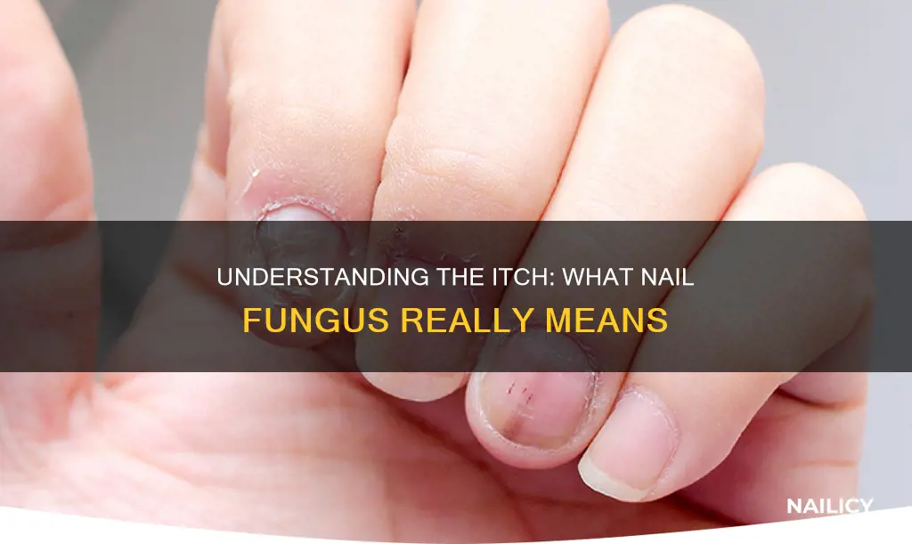 what does nail fungus mean