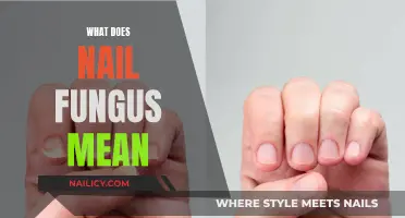Nail Fungus: What Does It Mean and Why?