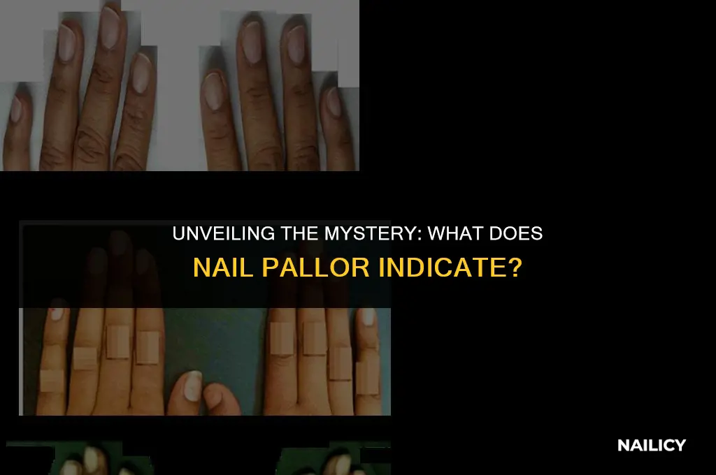 what does nail pallor indicate