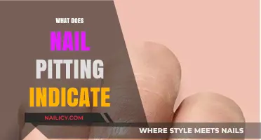 Unveiling the Hidden Signs: What Nail Pitting Really Indicates