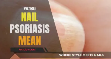 Understanding Nail Psoriasis: What Do Your Nails Indicate?