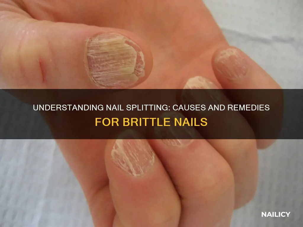 what does nail splitting mean