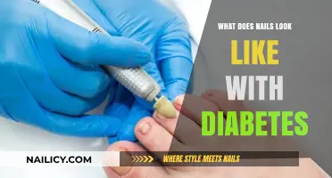 Diabetes and Nail Health: Recognizing Symptoms and Changes to Watch For