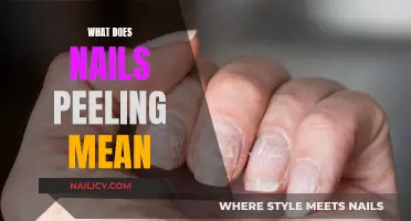 Nails Peeling: Understanding the Signs and Causes