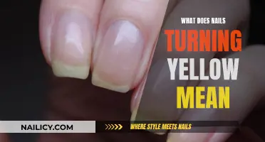 Yellow Nails: What Does It Mean When Nails Change Color?