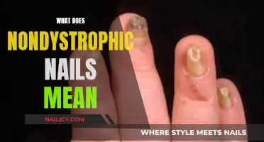 Understanding Nondystrophic Nails: A Comprehensive Guide to Nail Health