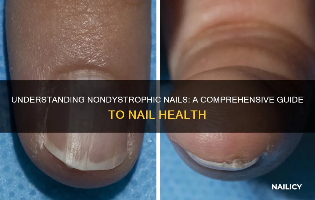 what does nondystrophic nails mean