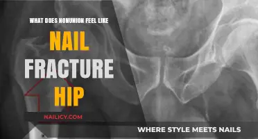 Nonunion Pain: Understanding Nail Fracture and Hip Healing Challenges