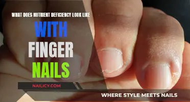 Unraveling Nutrient Deficiencies: How Your Nails Can Tell You're Missing Something