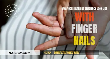 Nutrient Deficiency: What Your Fingernails Are Trying to Tell You