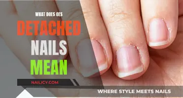 Understanding the Mystery: What Does Detached Nails Indicate?