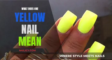 Yellow Nail Alert: What Does It Mean?