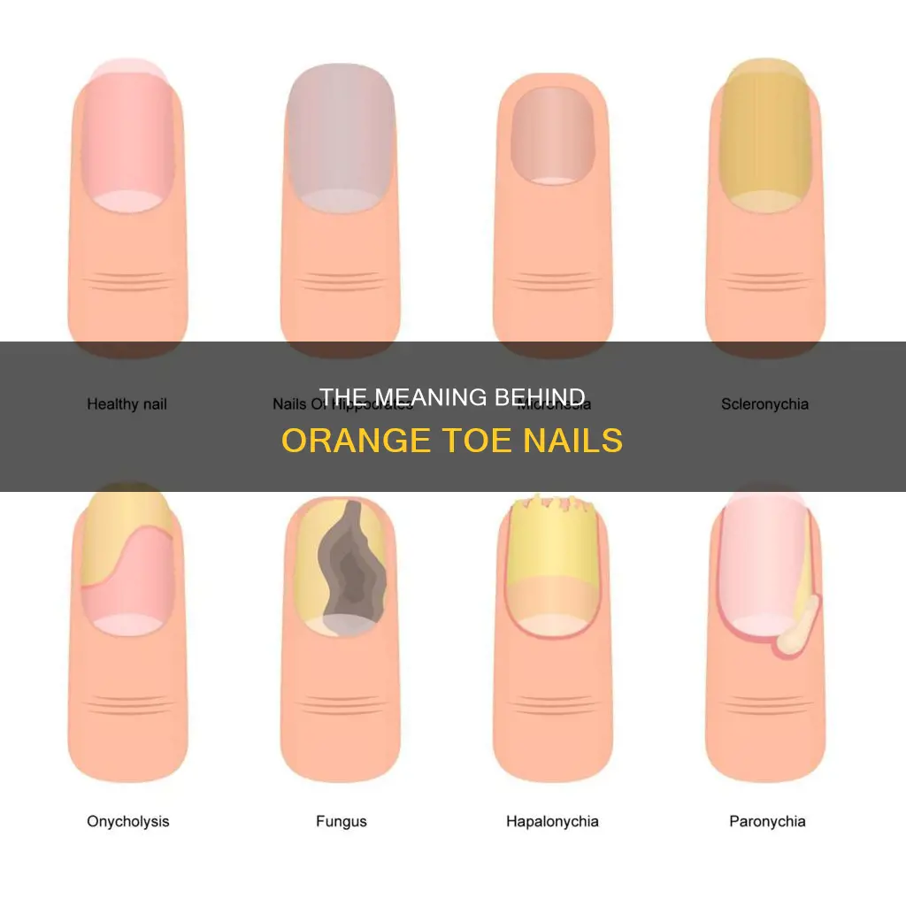 what does orange toe nails mean