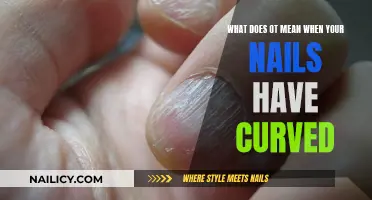 Curved Nails: What Your Nail Shape Says About Your Health