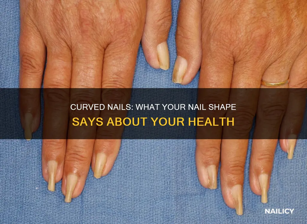 what does ot mean when your nails have curved