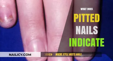 Unveiling the Secrets: What Pitted Nails Really Indicate